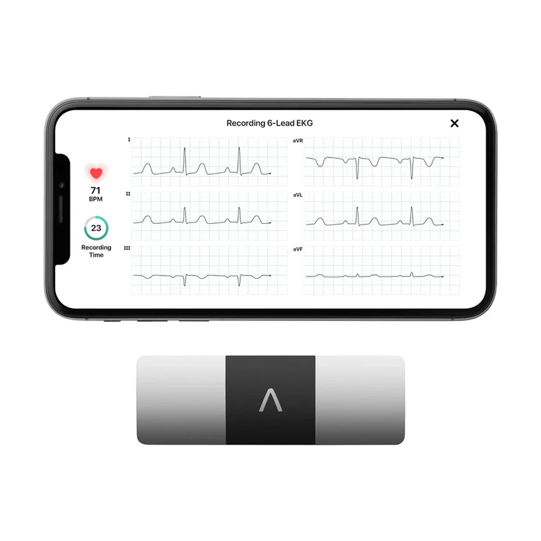 Personal EKG Monitor
