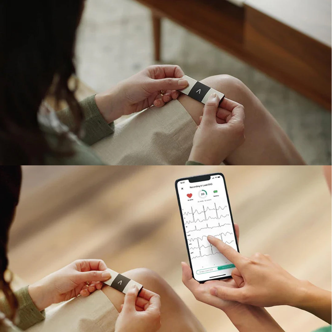 Personal EKG Monitor
